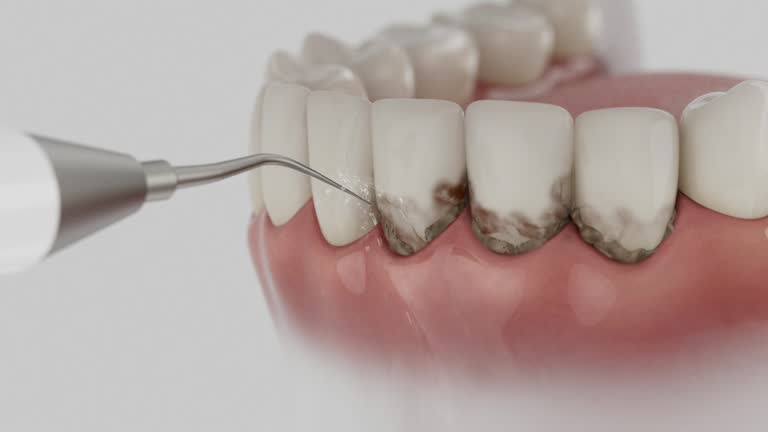 Trusted Tooth Extraction service in Tuckerman, AR - Dentist Open Now